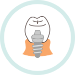 インプラント(人工歯根) インプラント(人工歯根)